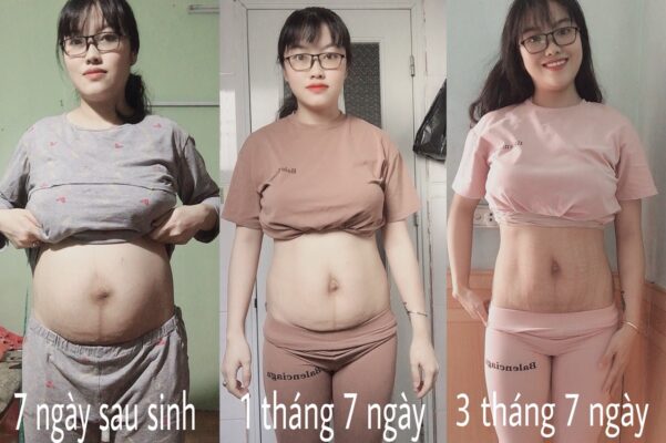 Latex giảm mỡ bụng sau sinh an toàn