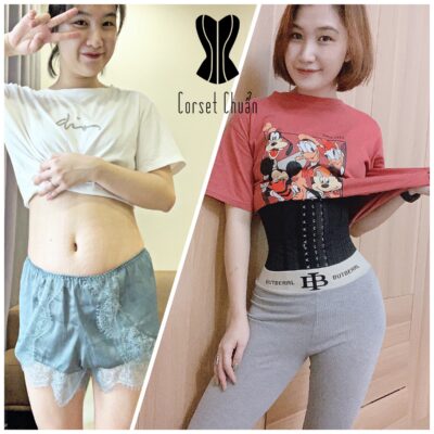 Latex giảm mỡ bụng hiệu quả